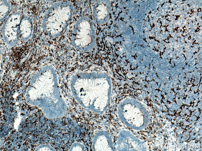 CD11c/Integrin alpha X Antibody in Immunohistochemistry (Paraffin) (IHC (P))