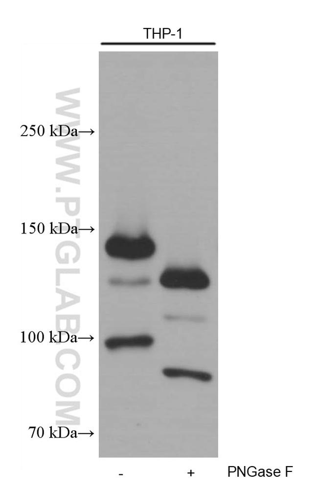 CD11c/Integrin alpha X Antibody in Western Blot (WB)