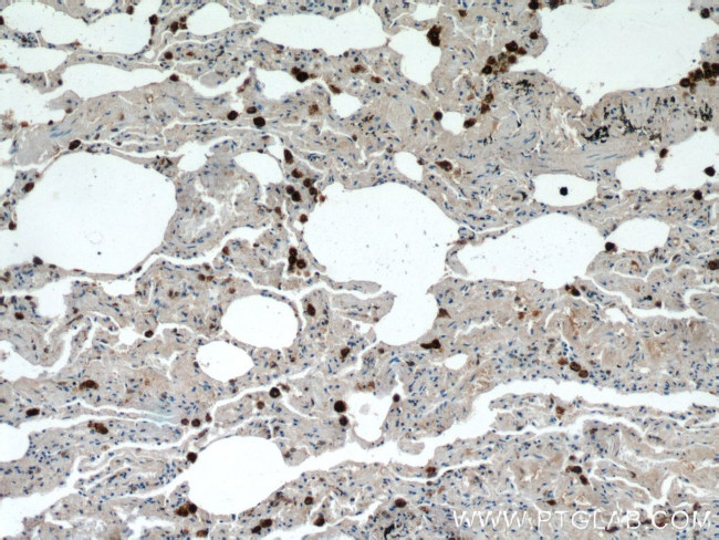 Napsin A Antibody in Immunohistochemistry (Paraffin) (IHC (P))