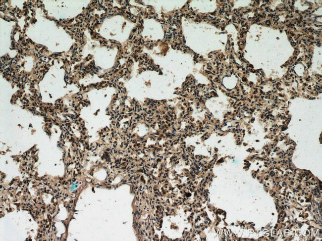 Napsin A Antibody in Immunohistochemistry (Paraffin) (IHC (P))