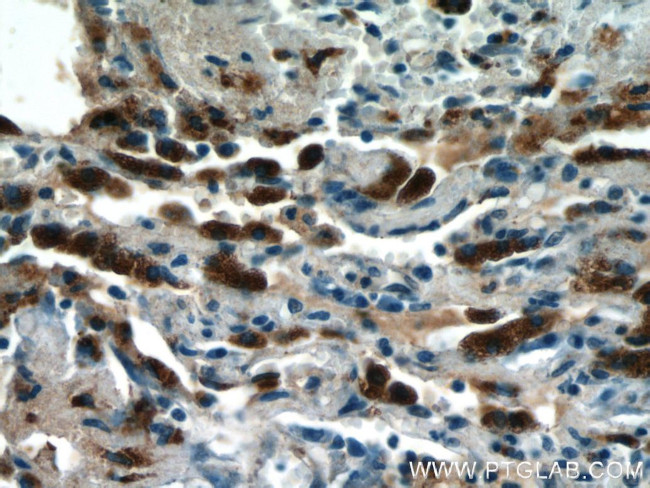 Napsin A Antibody in Immunohistochemistry (Paraffin) (IHC (P))