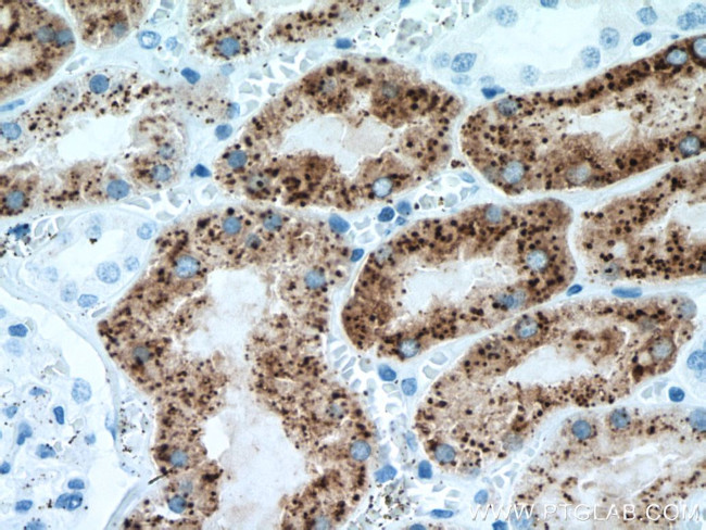 NAPSA Antibody in Immunohistochemistry (Paraffin) (IHC (P))