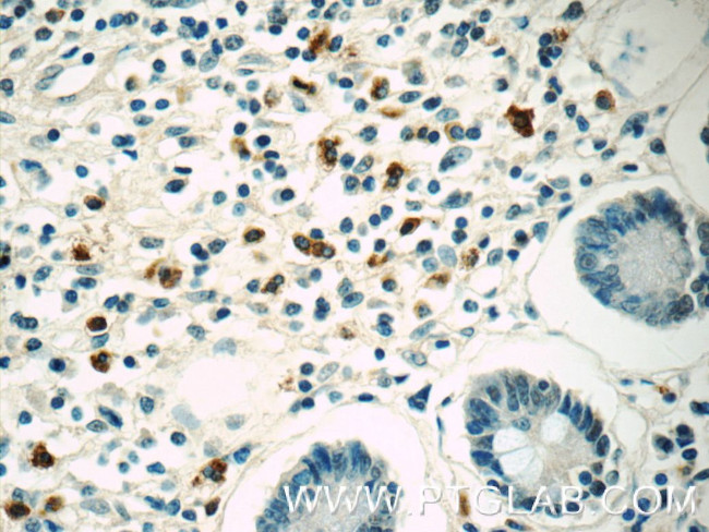 IL-28A Antibody in Immunohistochemistry (Paraffin) (IHC (P))