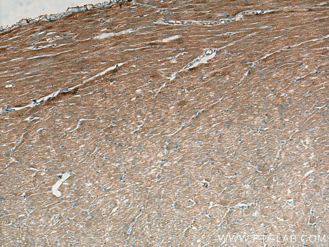 FABP3 Antibody in Immunohistochemistry (Paraffin) (IHC (P))