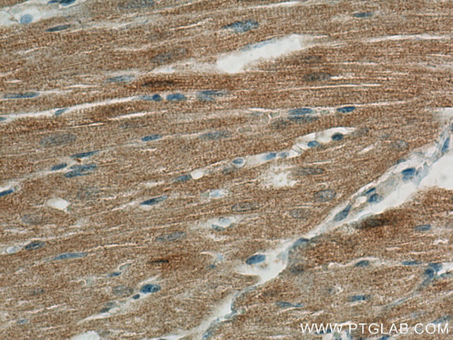 FABP3 Antibody in Immunohistochemistry (Paraffin) (IHC (P))