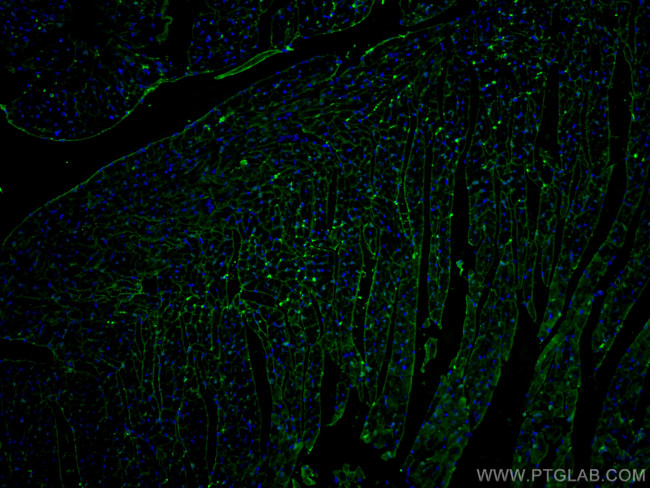 FABP3 Antibody in Immunohistochemistry (PFA fixed) (IHC (PFA))