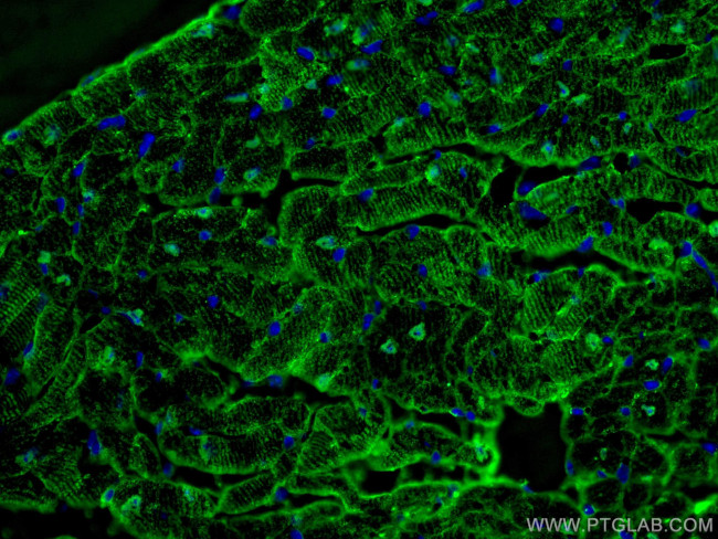 FABP3 Antibody in Immunohistochemistry (PFA fixed) (IHC (PFA))