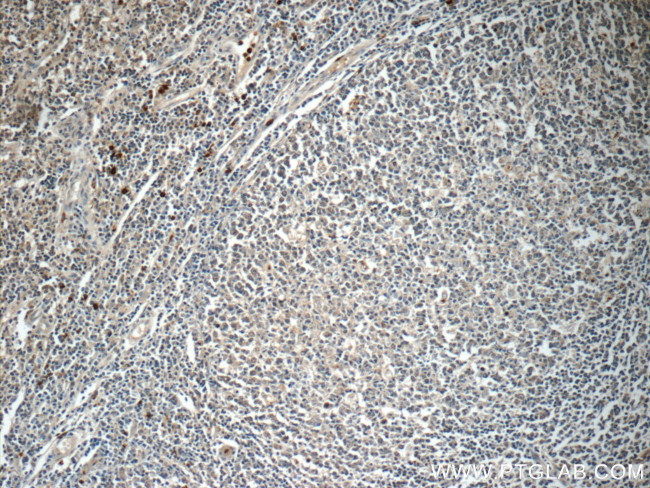 IL36 beta/IL1F8 Antibody in Immunohistochemistry (Paraffin) (IHC (P))