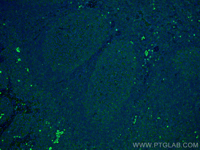 IL36 beta/IL1F8 Antibody in Immunohistochemistry (PFA fixed) (IHC (PFA))