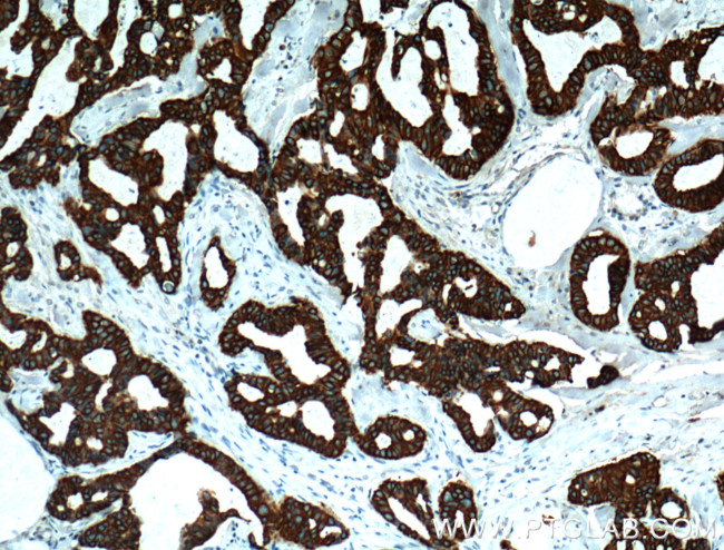 TNF alpha Antibody in Immunohistochemistry (Paraffin) (IHC (P))