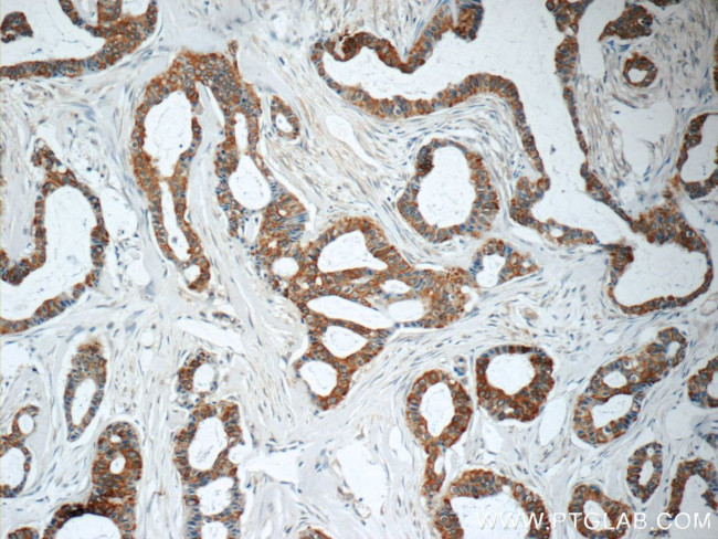 TNF alpha Antibody in Immunohistochemistry (Paraffin) (IHC (P))