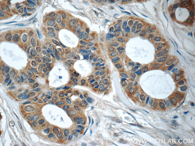 TNF alpha Antibody in Immunohistochemistry (Paraffin) (IHC (P))