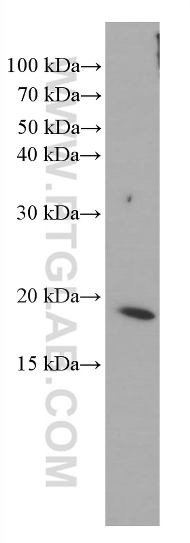 TNF alpha Antibody in Western Blot (WB)