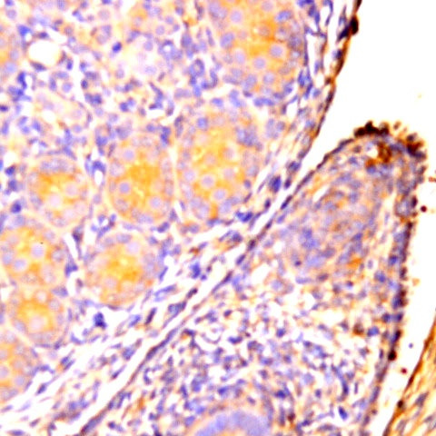 PAX8 Antibody in Immunohistochemistry (Paraffin) (IHC (P))