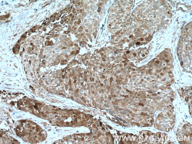 TNFAIP1 Antibody in Immunohistochemistry (Paraffin) (IHC (P))