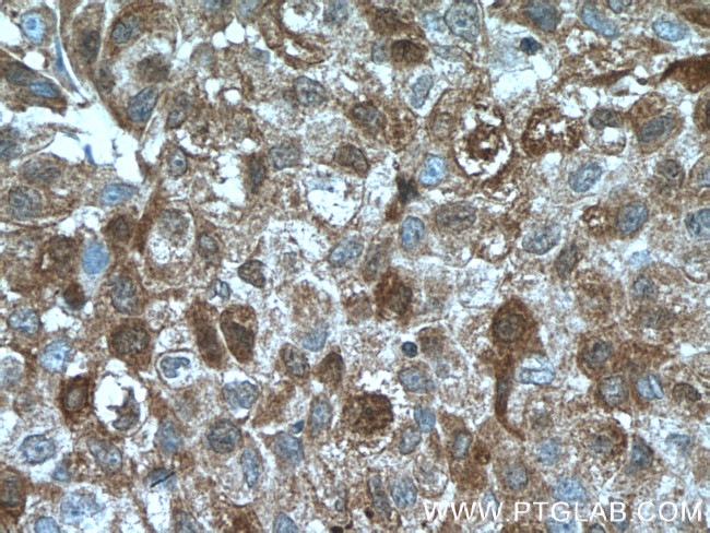 TNFAIP1 Antibody in Immunohistochemistry (Paraffin) (IHC (P))