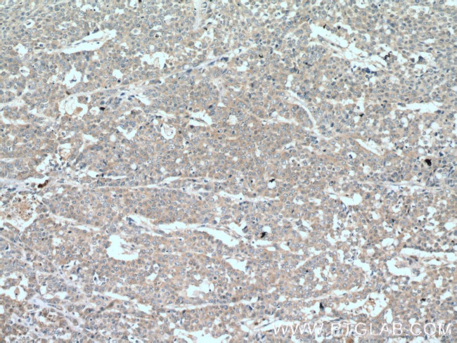 TNFAIP1 Antibody in Immunohistochemistry (Paraffin) (IHC (P))