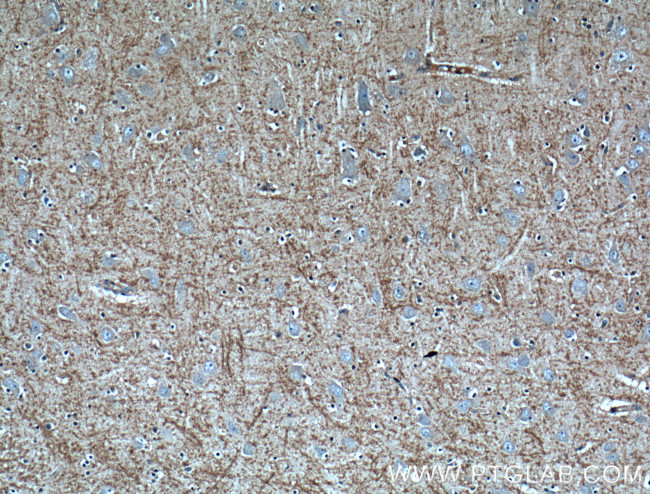 CX3CL1 Antibody in Immunohistochemistry (Paraffin) (IHC (P))