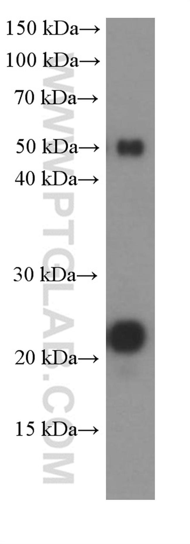 CD3 gamma Antibody in Western Blot (WB)