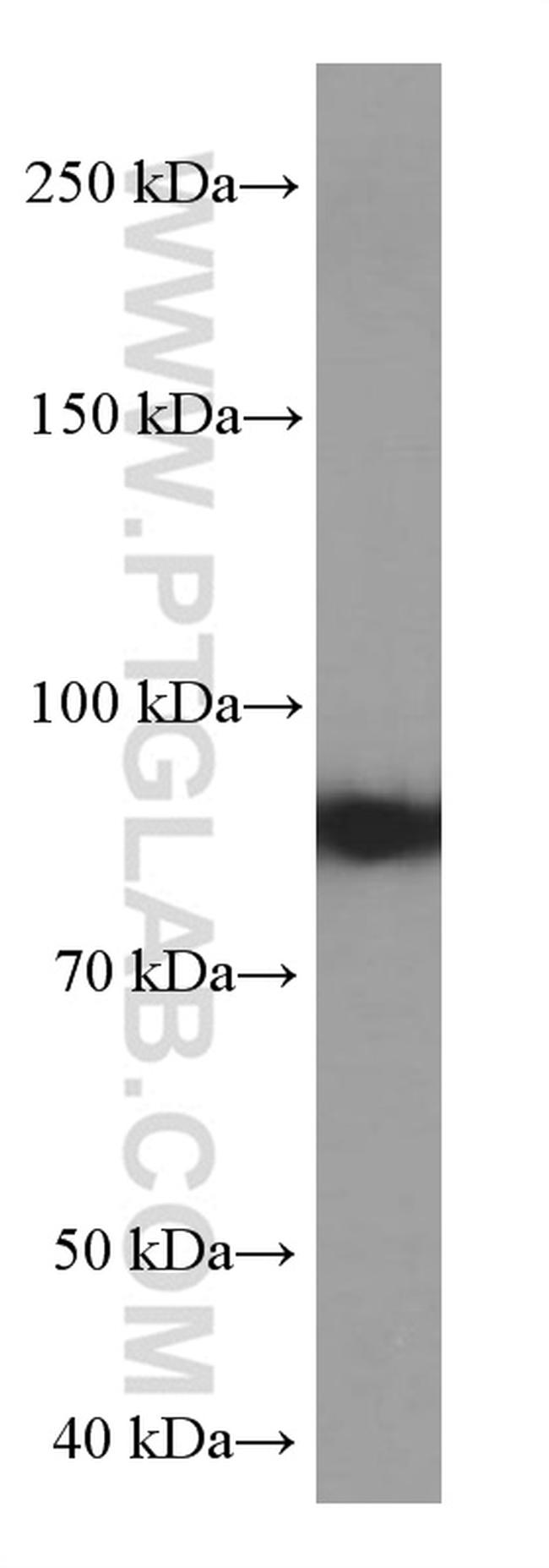 MUM1 Antibody in Western Blot (WB)