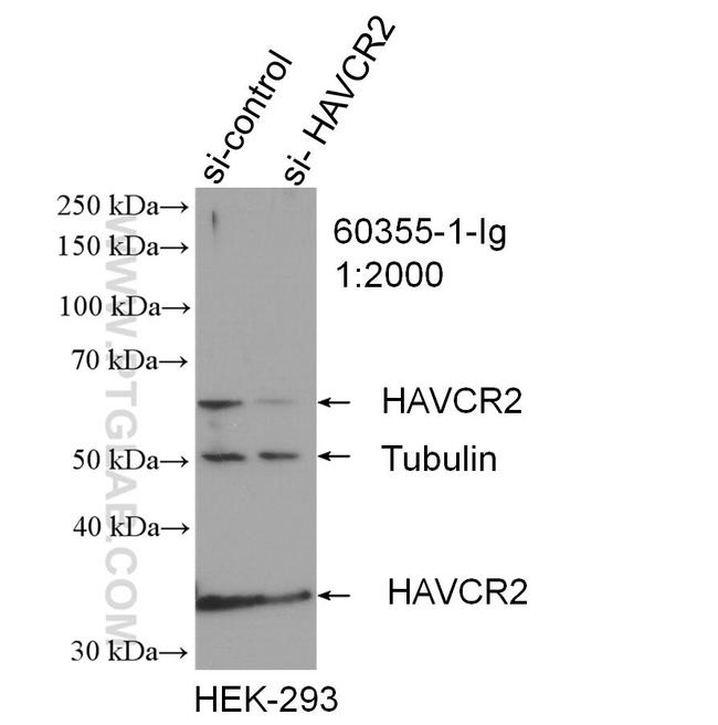 TIM3 Antibody in Western Blot (WB)