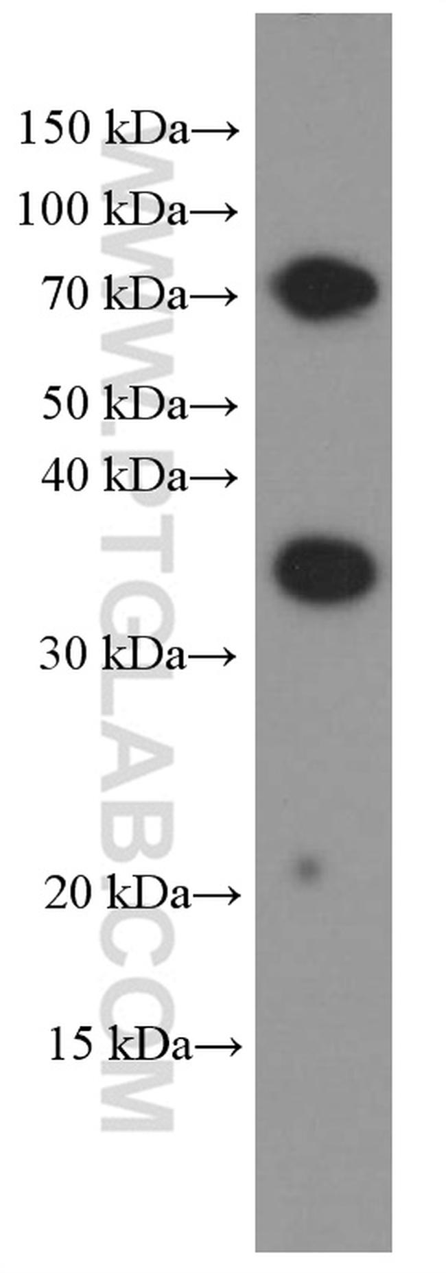 TIM3 Antibody in Western Blot (WB)