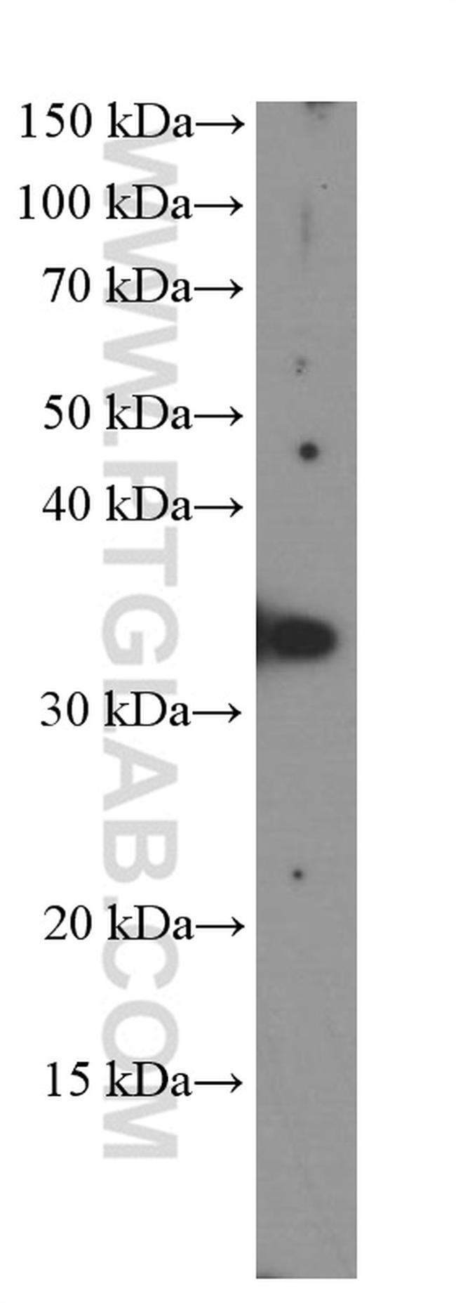 TIM3 Antibody in Western Blot (WB)