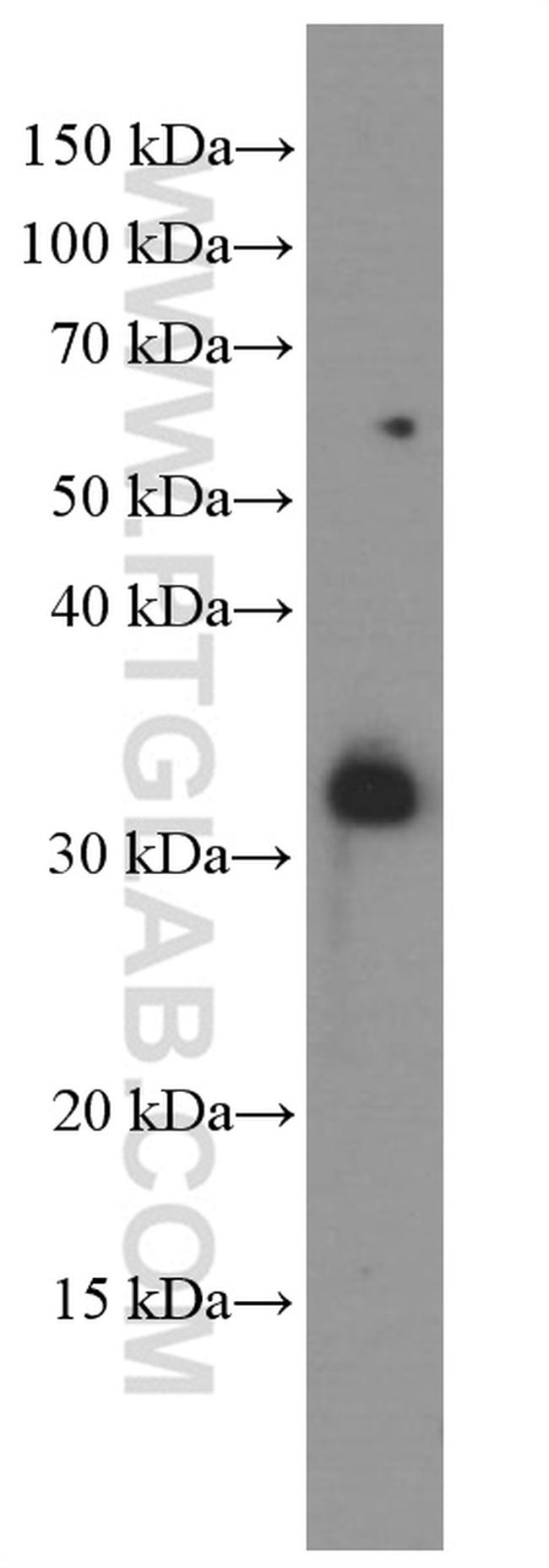 TIM3 Antibody in Western Blot (WB)