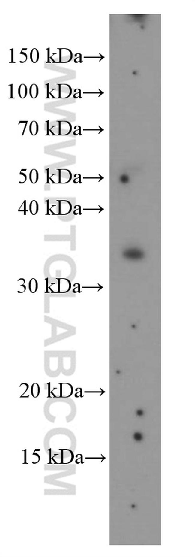 TIM3 Antibody in Western Blot (WB)