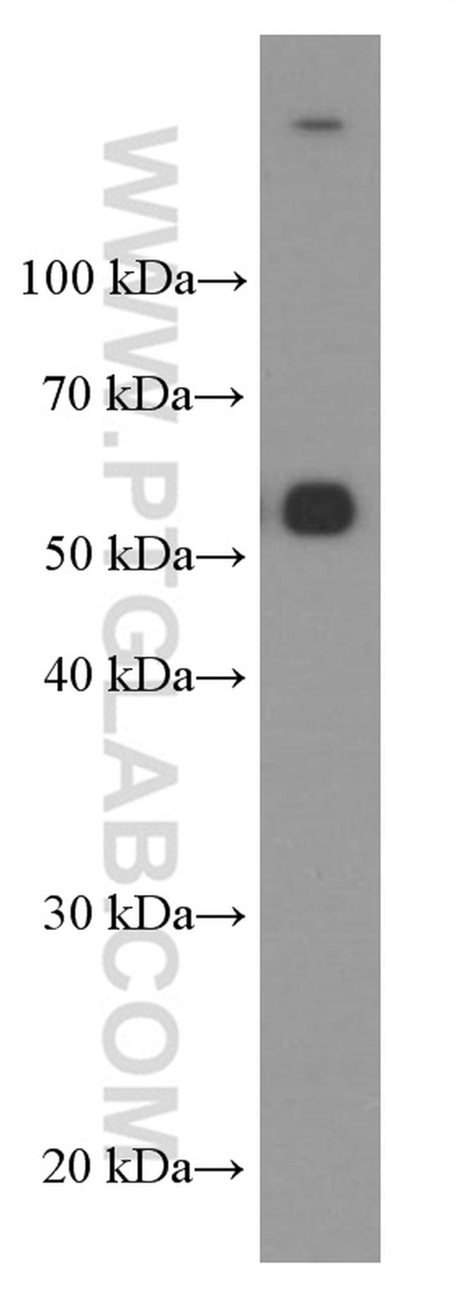 TIM3 Antibody in Western Blot (WB)