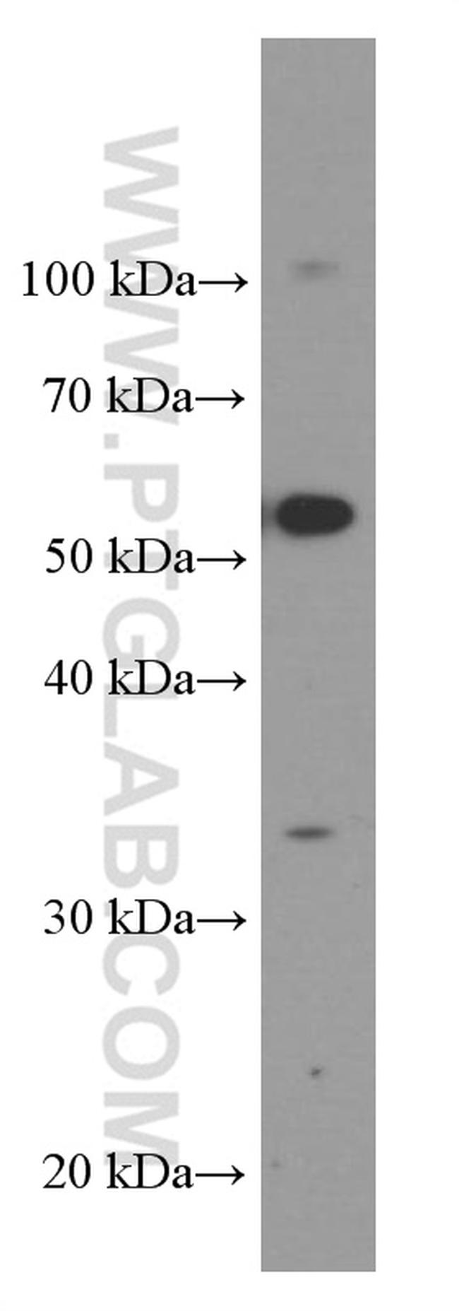 TIM3 Antibody in Western Blot (WB)