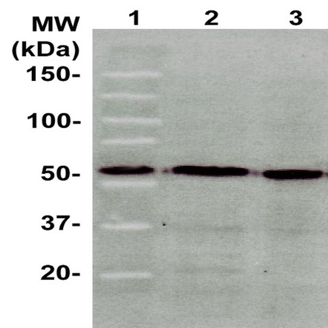 ATF2 Antibody in Western Blot (WB)