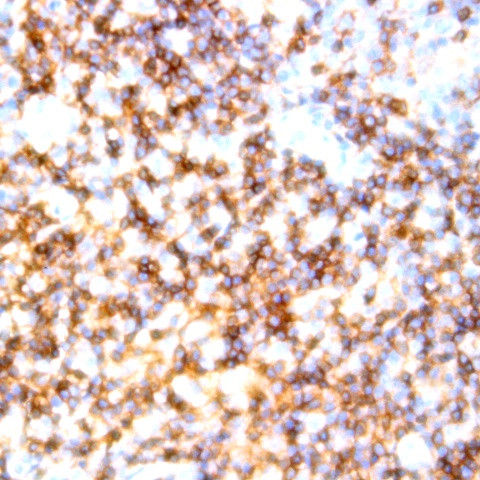 CD10 Antibody in Immunohistochemistry (Paraffin) (IHC (P))