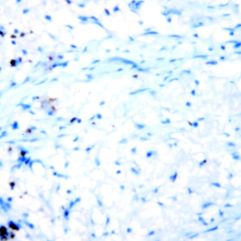 CD127 Antibody in Immunohistochemistry (Paraffin) (IHC (P))