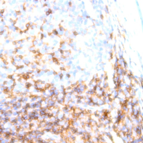 HLA-DR Antibody in Immunohistochemistry (Paraffin) (IHC (P))