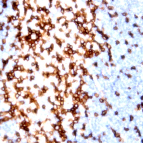 CD75s Antibody in Immunohistochemistry (Paraffin) (IHC (P))