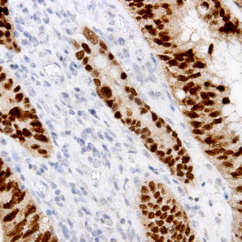 STAT5 Antibody in Immunohistochemistry (Paraffin) (IHC (P))