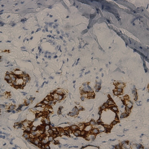 Cytokeratin 17 Antibody in Immunohistochemistry (Paraffin) (IHC (P))