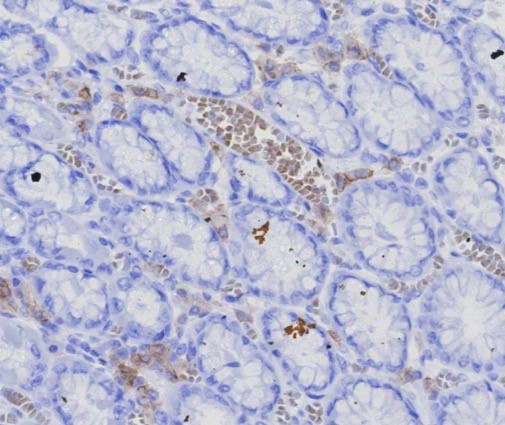 CD269/TNFRSF17/BCMA (B-Cell Maturation Protein) Antibody in Immunohistochemistry (Paraffin) (IHC (P))