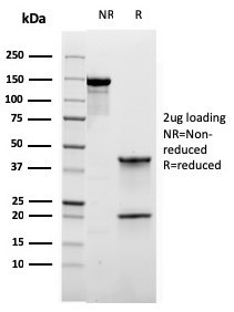 ROR-gamma/RORC (RAR-related Orphan Receptor C) Antibody in SDS-PAGE (SDS-PAGE)