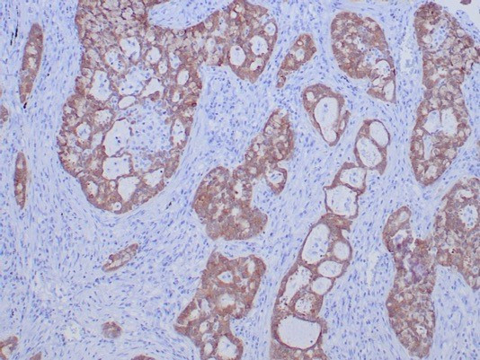 ROS1 Antibody in Immunohistochemistry (Paraffin) (IHC (P))