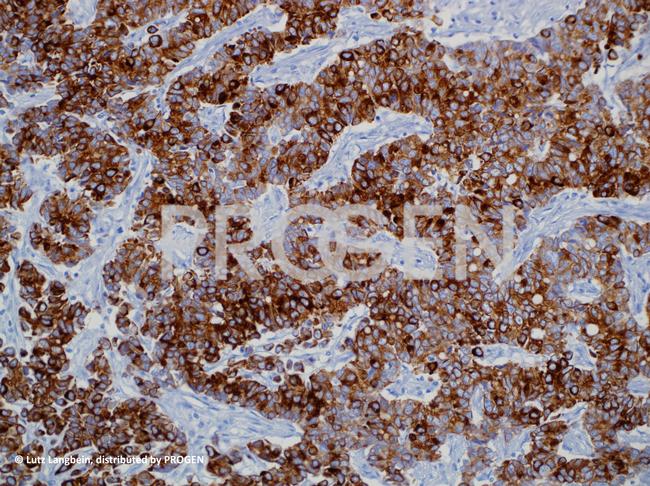 Cytokeratin 20 Antibody in Immunohistochemistry (IHC)