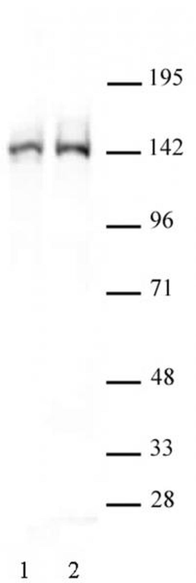 FancD2 Antibody in Western Blot (WB)