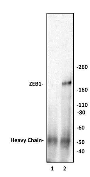 ZEB1 Antibody in Immunoprecipitation (IP)