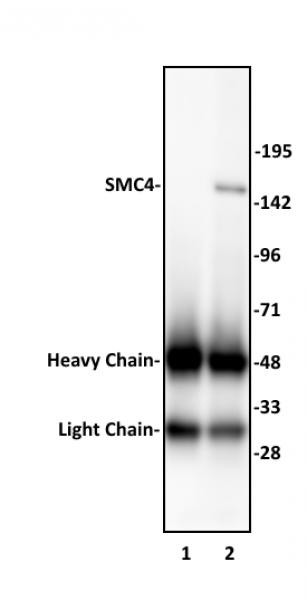 SMC4 Antibody in Immunoprecipitation (IP)