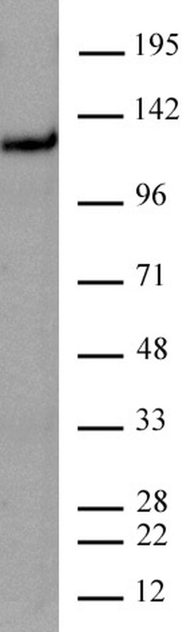 CtIP Antibody in Western Blot (WB)