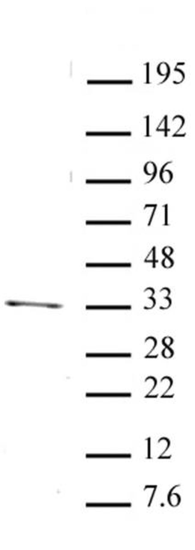 PITX2 Antibody in Western Blot (WB)