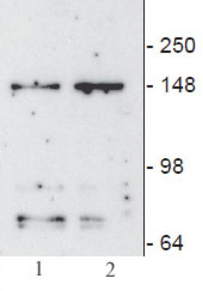 JMJD3 / KDM6B Antibody in Western Blot (WB)