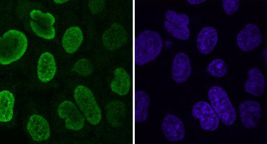 Histone macroH2A1.2 Antibody in Immunocytochemistry (ICC/IF)