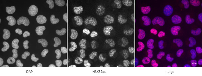 Histone H3K37ac Antibody in Immunocytochemistry (ICC/IF)